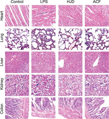 The interaction of <mark class="highlighted">MD-2</mark> with small molecules in huanglian jiedu decoction play a critical role in the treatment of sepsis